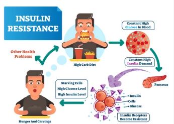 Insulin Sensitivity vs. Insulin Resistance