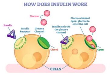 What is Insulin Resistance?