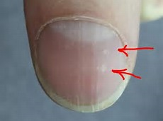 white mark on nail for zinc test deficiency pH testing strips